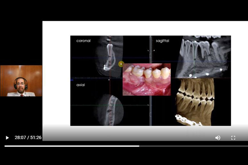 Dr.-Tarek-24th-webinar-2