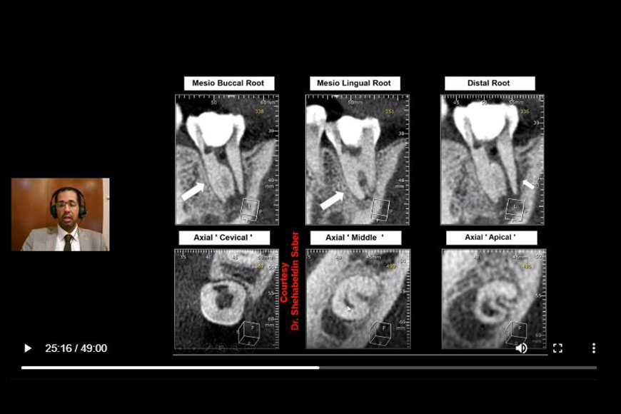 Dr.Tarik-CBCT1