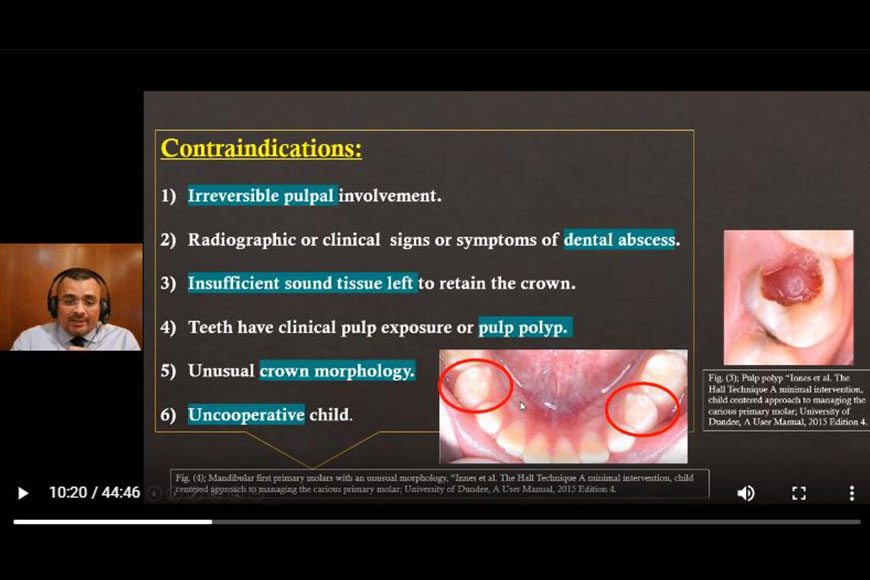 Dr.Ahmed-1st-April-Hall-Technique-2